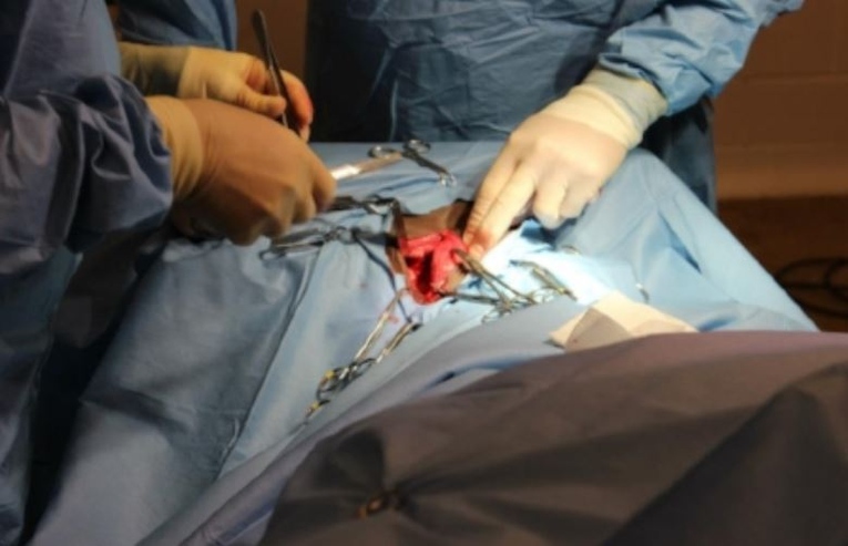 Wind Surgery Operation