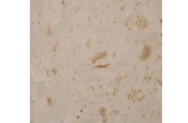 Marble