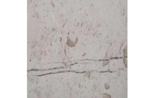 Marble
