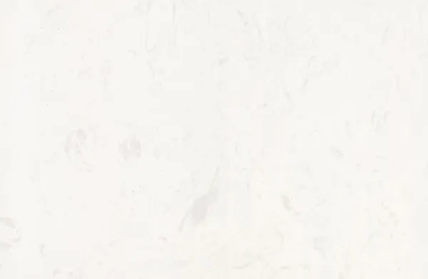 Artificial Marble  JS017